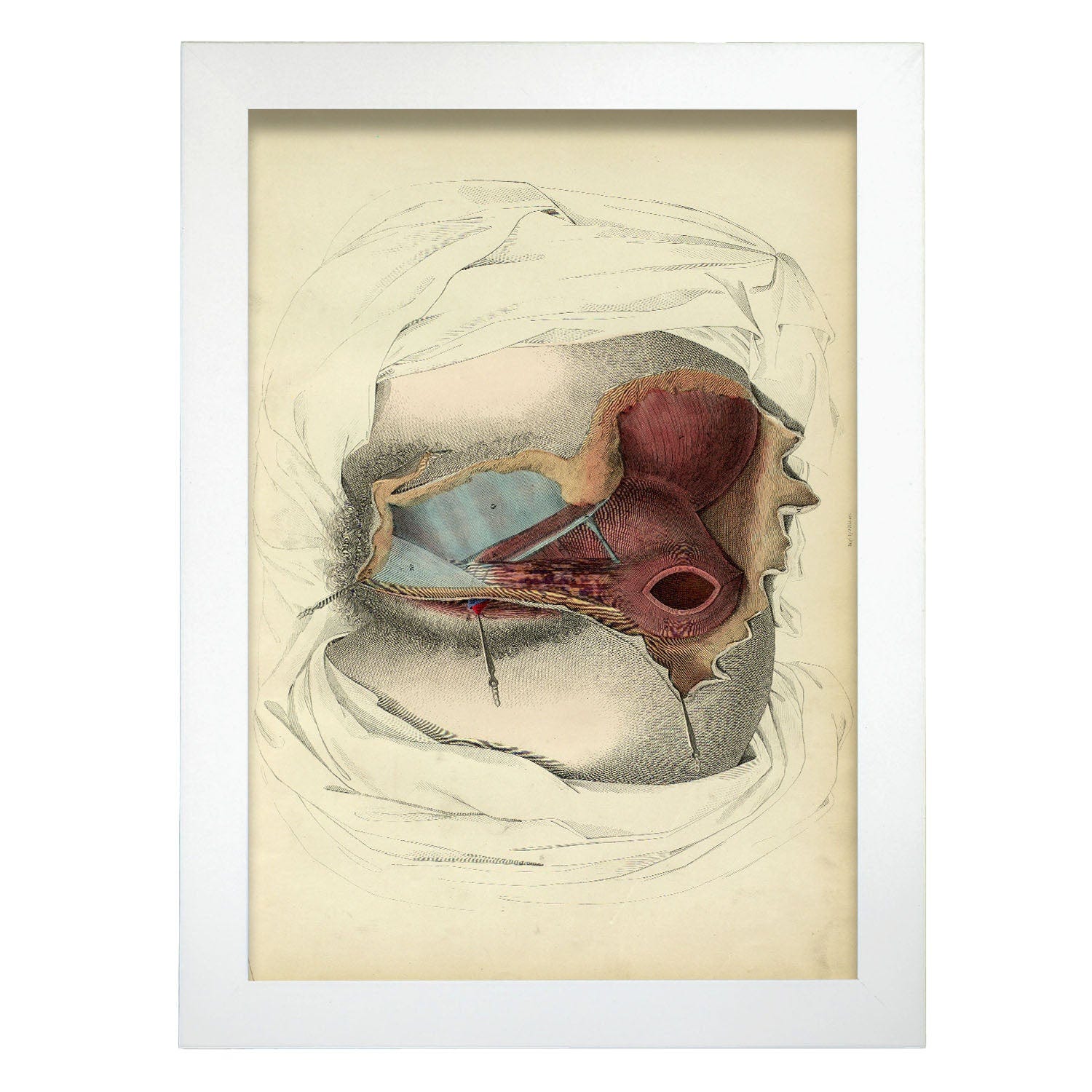 Poster Di Dissezione Di Perineo Illustrazioni Decorative Di Anatomia E  Medicina In Stile Design Degli Interni A3 Con Cornice Nera Senza Cornice