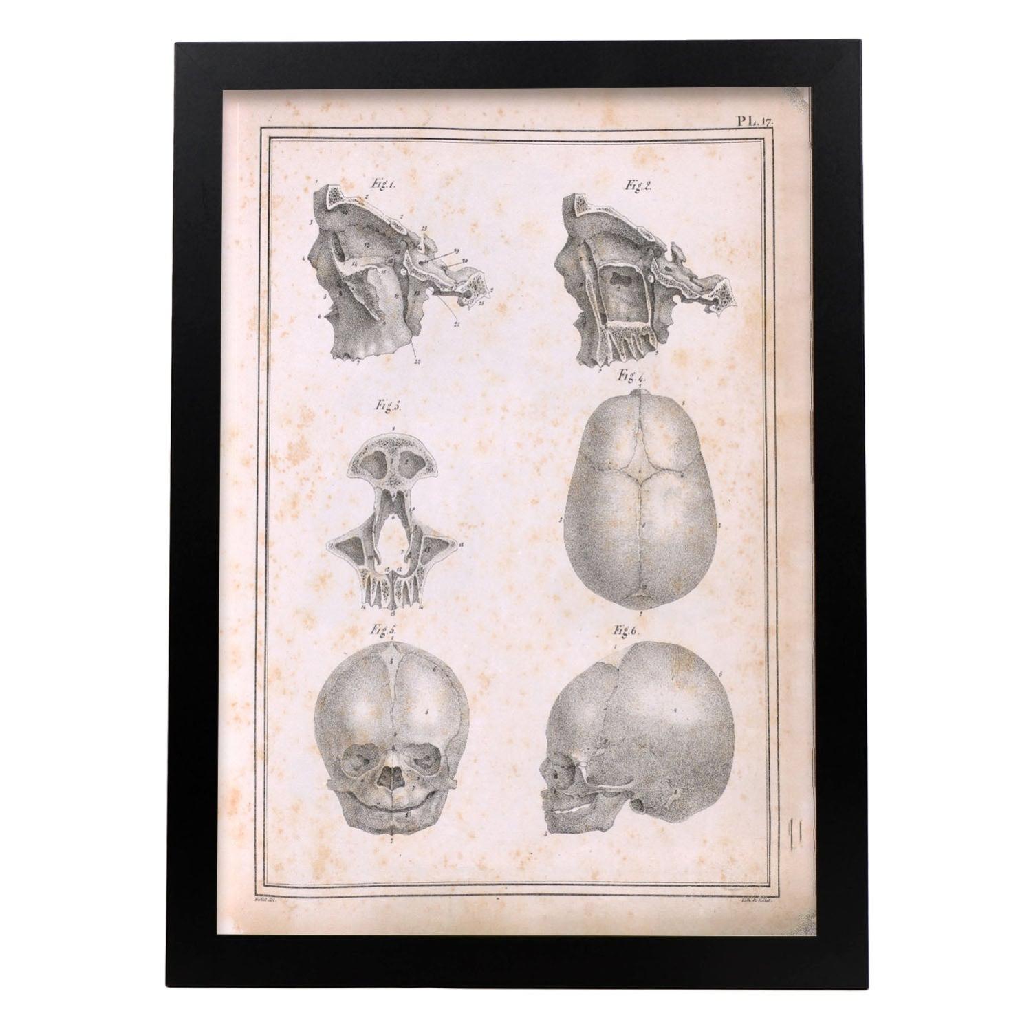 Anatomie 2000 - Céji - 1973 - Generation JOUETS