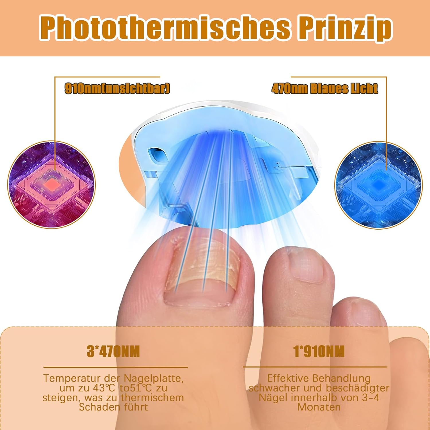 Appareil Traitement Laser Mycose Ongles Mycose Ongles des Pieds Nettoyage et Réparation Ongles Traitement Champignons Ongles Infections (4 lampes) - 2