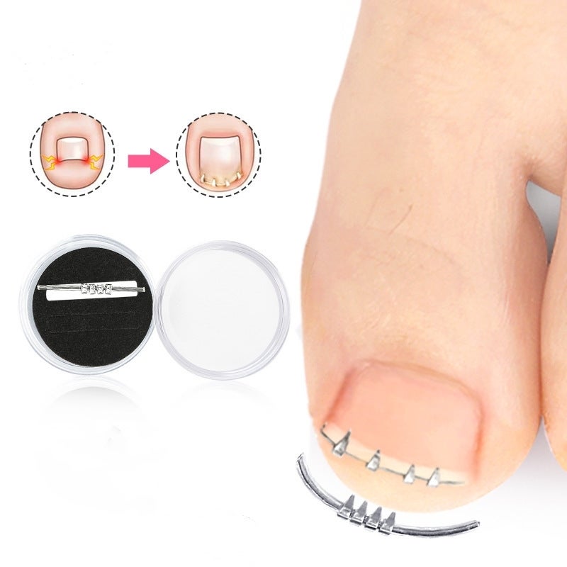 100 Pezzi Di Adesivi Per La Correzione Delle Unghie - Foto 11