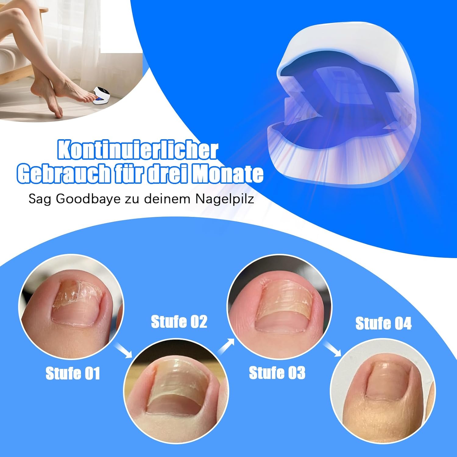 Mycose des ongles laser Action rapide Haute efficacité - Thérapie laser à froid Traitement de plusieurs orteils et pieds confortables（6 lampe) - 3