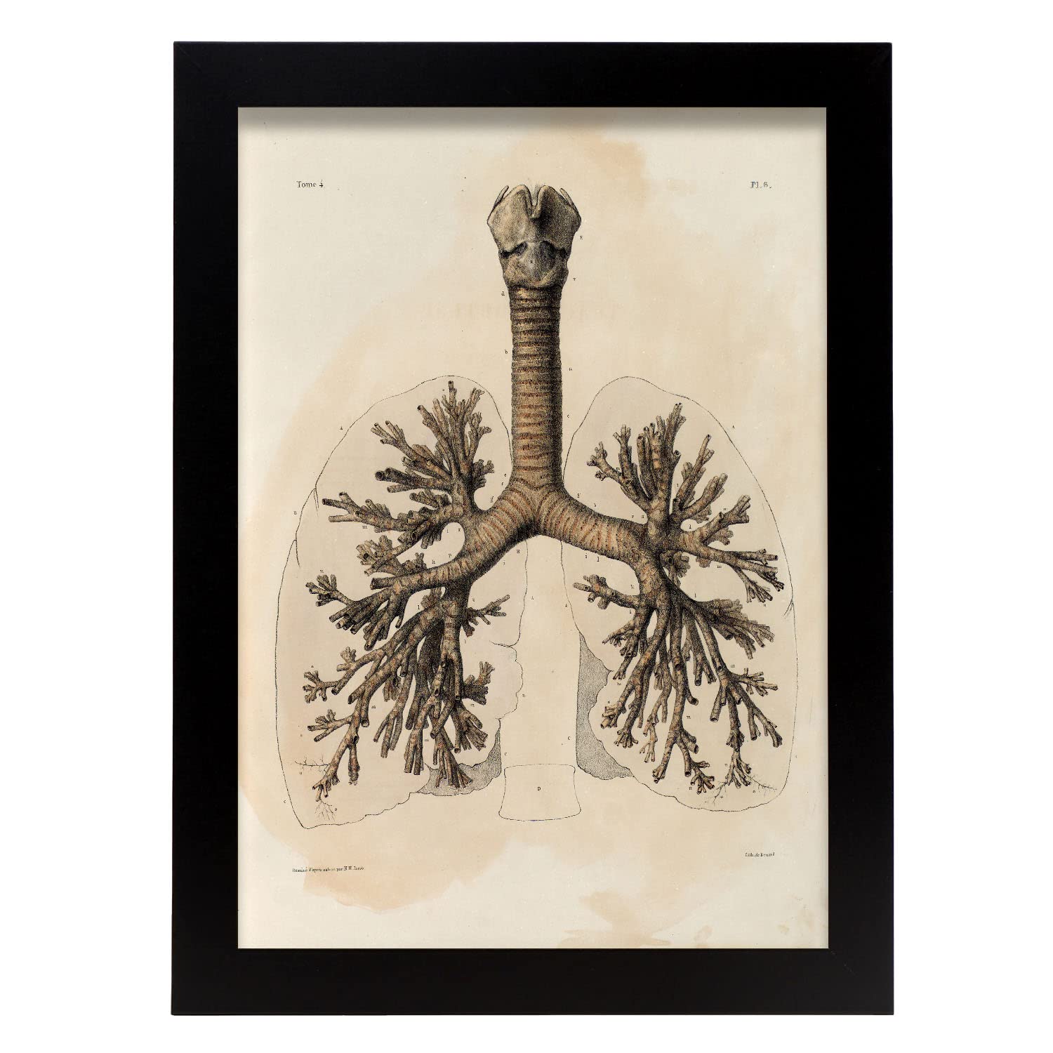 Nacnic póster de bronquios ilustraciones decorativas de anatomía y medicina en estilo vintage diseño y tamaño a3 con marco negro