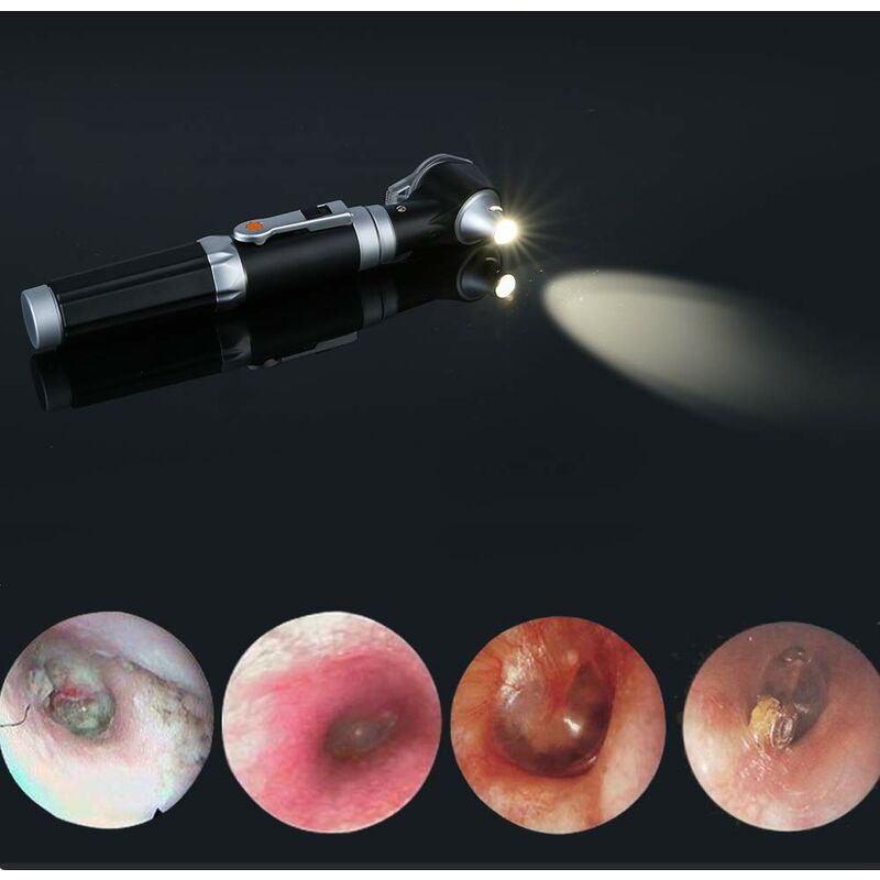 Mini Otoscope Oreille,Grossissement Diagnostic Inspection Scope de l'oreille avec LED Illumination Directe Oreille Outil Sain pour Médecins - 4