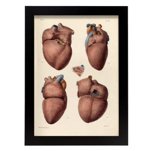 Poster D'anatomie Musculaire Sur Soie - Détail Complet, Parfait Pour La Classe, L'hôpital Ou La Déco Murale