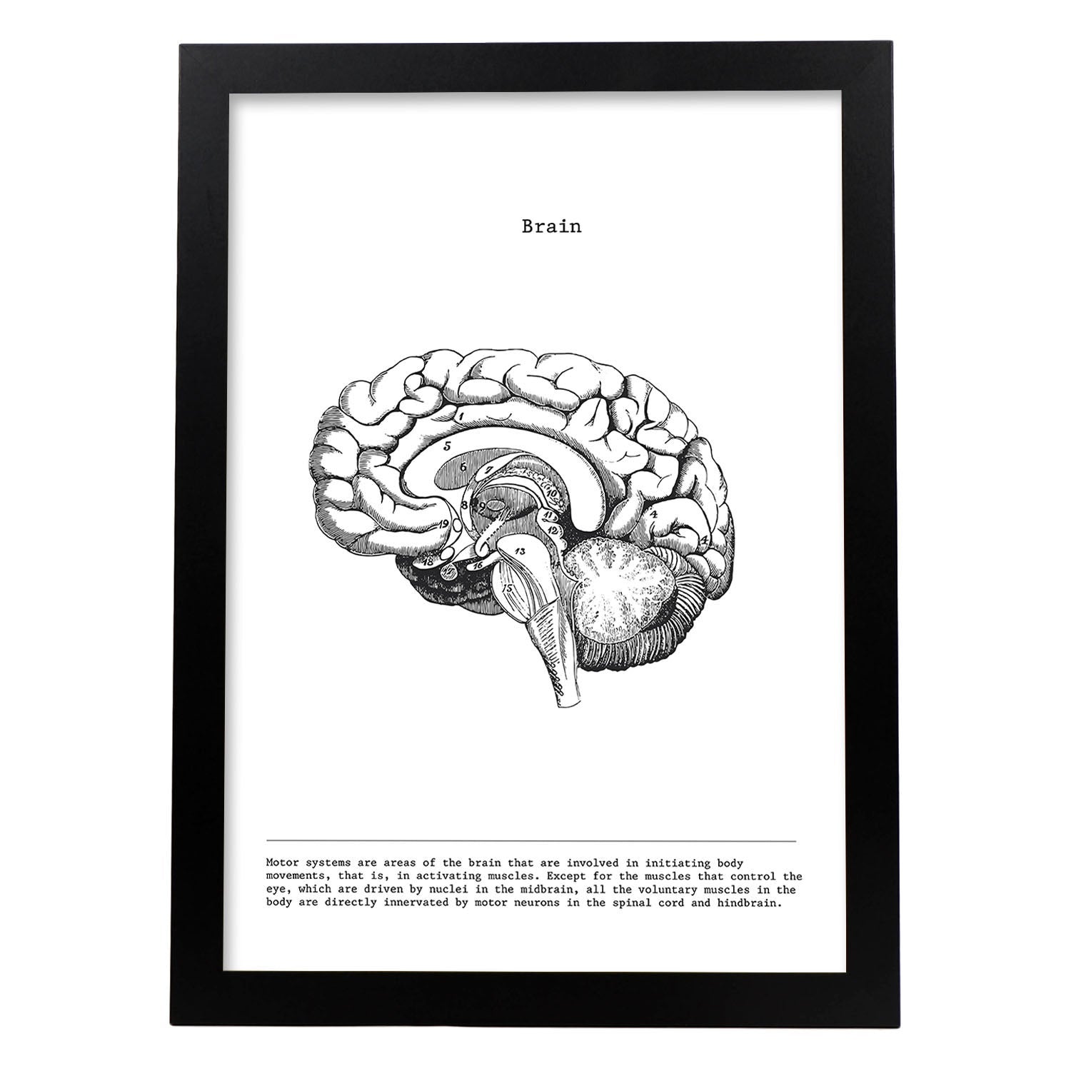 Empireposter Puzzle 1000 Pezzi - Funzione Del Cervello, Anatomia E Chirurgia - 68x48 Cm - Cartone Robusto Con Struttura In Lino - Idea Regalo Per Appassionati Di Medicina
